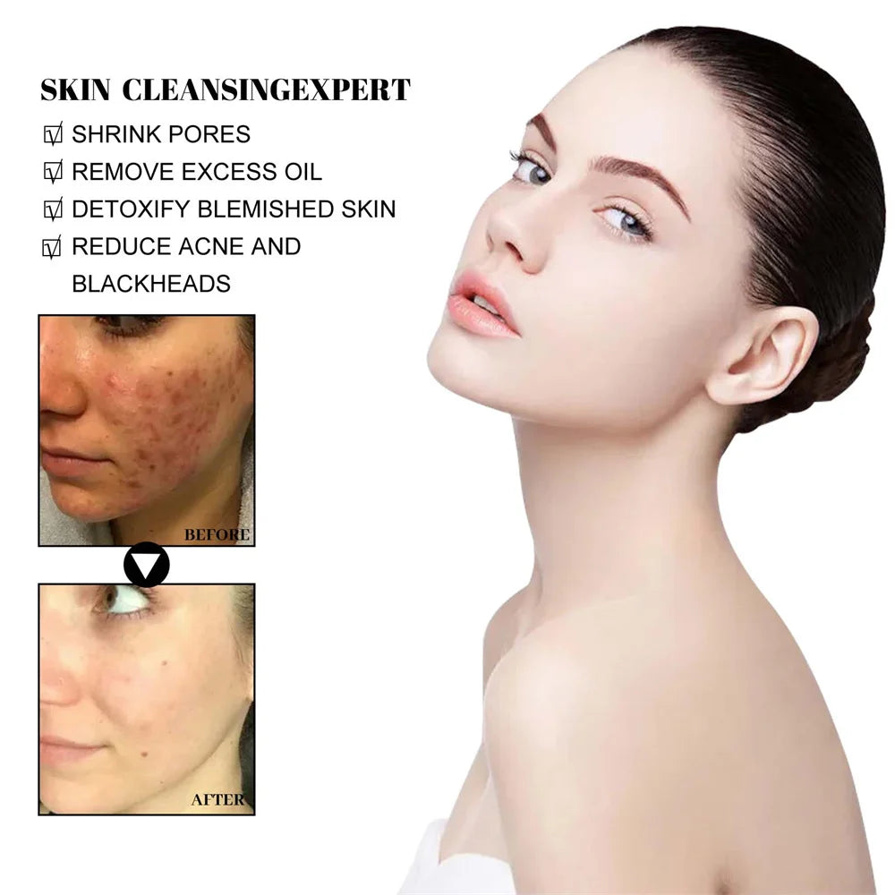 West & Month Blackhead Removing Solid Mud Face Mask