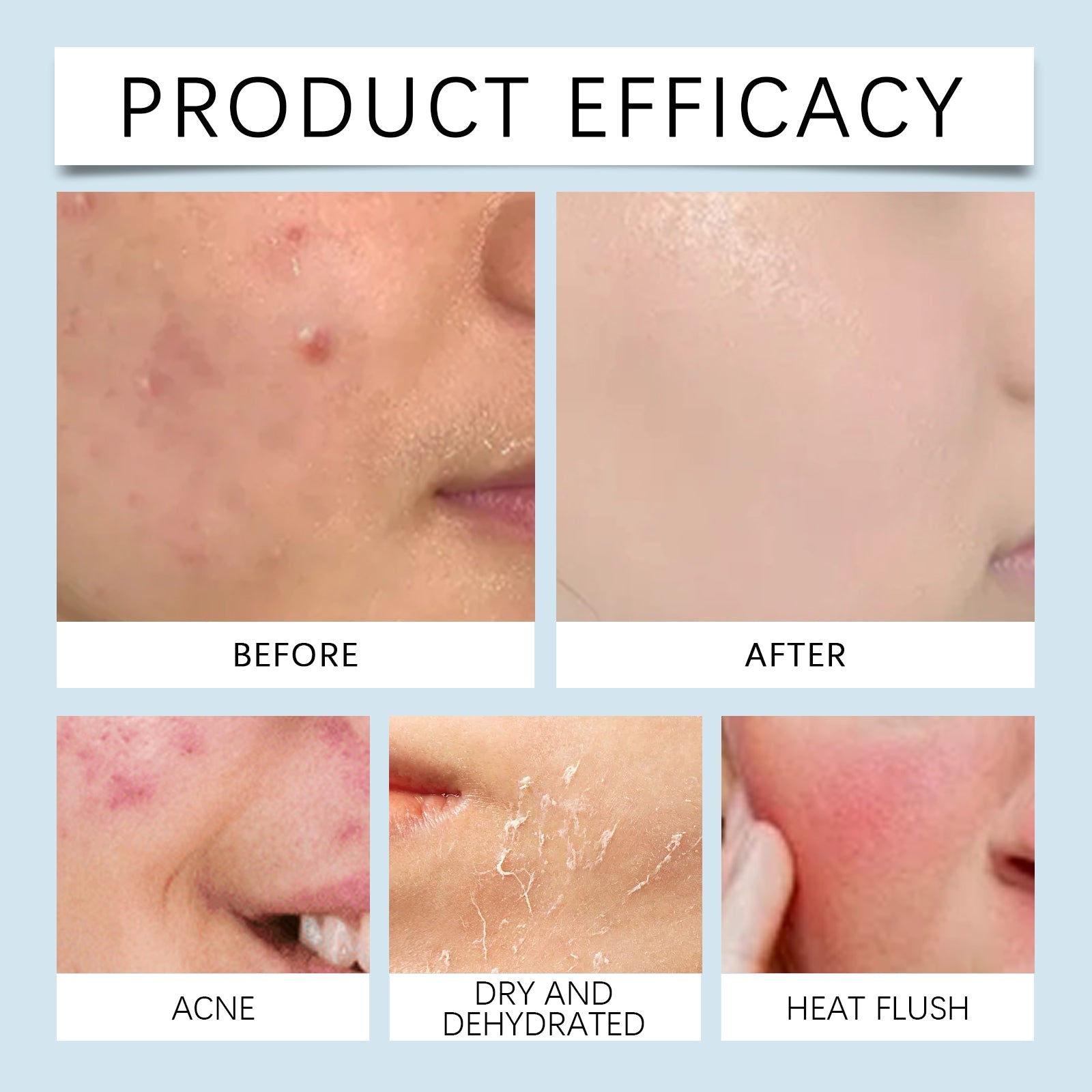 Hyaluronic Acid Face Serum Hydrating Radiance Pore Care